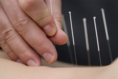 Acupuntura em nosso espaço.