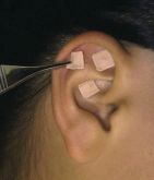 Auriculoterapia - Atendimento em domicílio