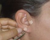 Auriculoterapia em nosso espaço