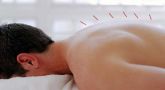 Acupuntura -  Atendimento em domicílio